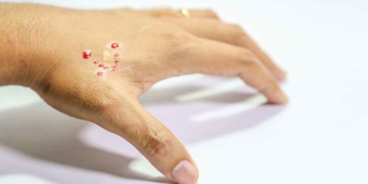 892B1D9A-1D2A-4835-A871-C5B0AB00605C